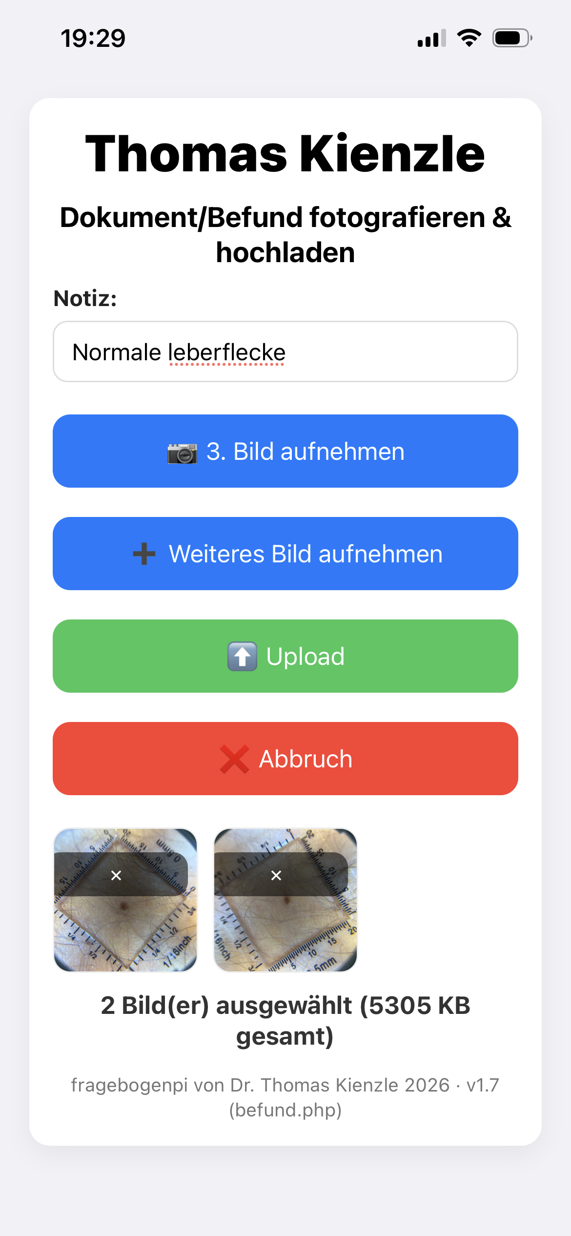 Zwei Leberfleckbilder zur Befunddokumentation ausgewählt